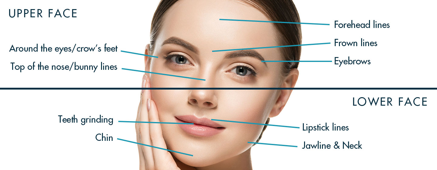 What areas can Botox treat